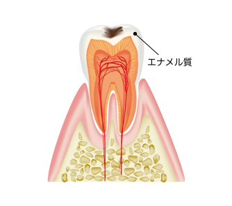 case.1