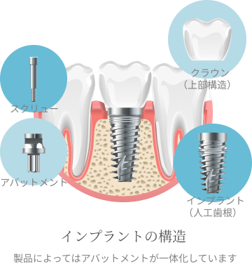 幅広い口腔外科治療に対応しています